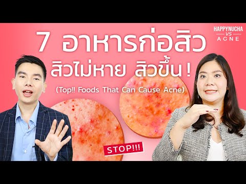 7 อาหารที่ทานแล้วเกิดสิว อาหารก่อสิว สิวเห่อ สิวไม่หาย | Foods That Can Cause Acne